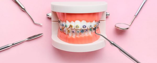 orthodontie