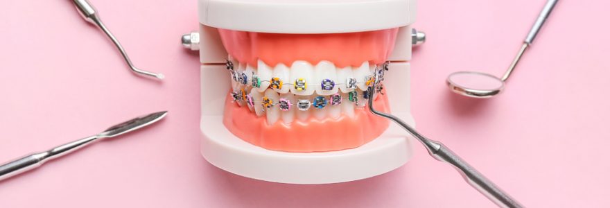 orthodontie